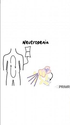 "If I experience neutropenia during chemo, how can I prevent an infection?"