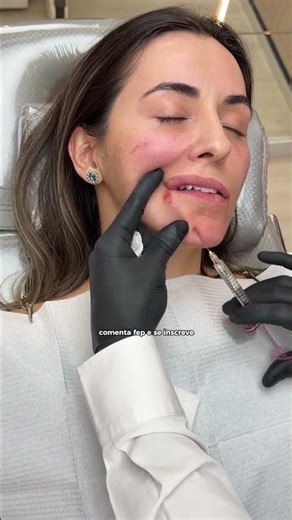 Clinical Cases