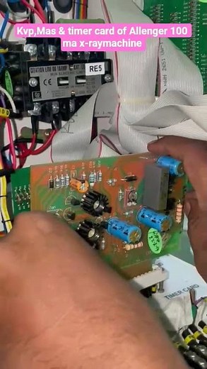 "Inside the KVP, mAs & Timer Card 🔥 | Allengers 100mA X-Ray Secret Revealed!"