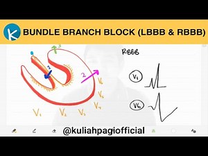 Basic ECG (18/20) - Bundle Branch Block - LBBB and RBBB