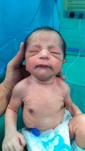 5.2K views · 106 reactions | Moro reflex #baby #newborn | Babycurecare Twi | Facebook