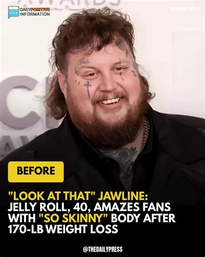 After shedding 170 pounds, Jelly Roll’s transformed jawline has fans in total shock. The before-and-after pictures are unbelievable  (check in the first comment) | VD Inspire | Facebook