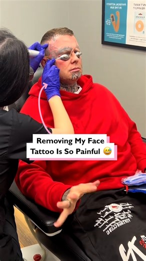 160K views · 178 reactions | Face tattoo removal is another level of pain  #fblifestyle | Four Nine | Facebook