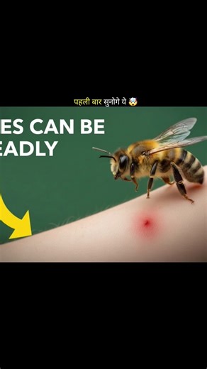 Bee sting a human 😱 #shorts