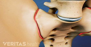 2 Little-Known Treatments to Relieve Sacroiliac Joint Pain