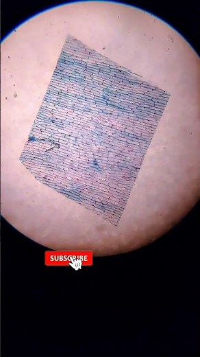 What’s Inside an Onion Cell? 🧅