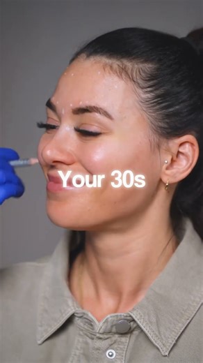 5 Things You MUST Know Before Getting Botox! 💉⚠️ #botox #botoxfiller