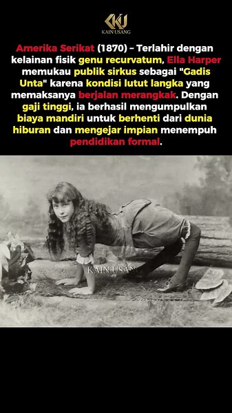 Ella Harper, Si Gadis Unta