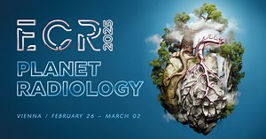 Guidelines for creating and using polls in Slido