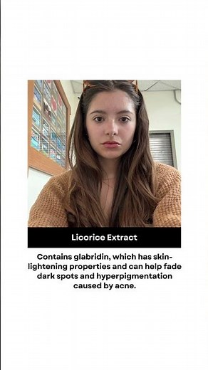 How to Fade Acne Marks Completely (2026 Science-Based Protocol) #AcneMarks #ClearSkin2026