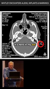 47K views · 592 reactions | Whitley Strieber's Alien Implant and Contact Saga | Ancient Astronaut Theorists | Facebook