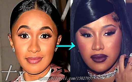 《Cardi B整容史》14种项目可能 Plastic Surgery | 高清剪辑.十x
