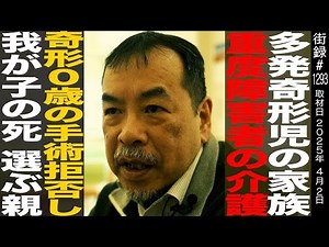 Pediatric surgeon Masanori Matsunaga / Family of a child with multiple birth defects / Care of a ...