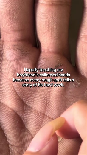 Loving Your Boyfriend's Calloused Hands