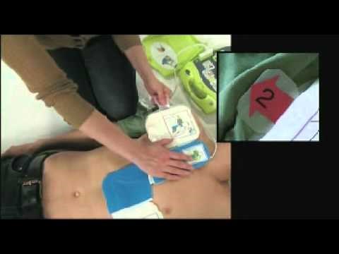 Applying Electrodes and Delivering a Shock with the AED Plus