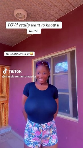 Massive Macromastia (19) | massive