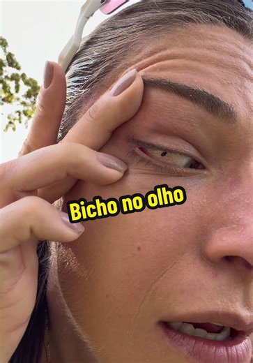 QUE AFLIÇÃO😫 #bicho #olho #corrida #oculos #run | run