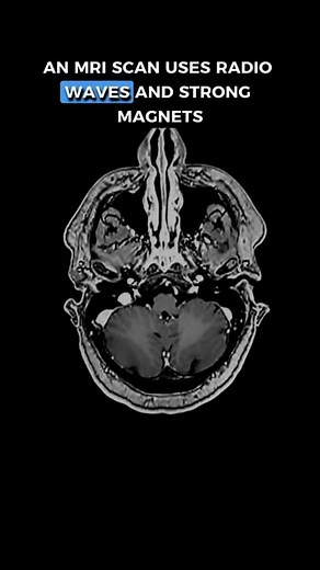 Medic Mentor on Instagram: "Curious about scanning technologies like CT, MRI, and PET? Let's explore their workings and unique capabilities! 🤩 These scans each have their unique powers, allowing doctors to uncover secrets hidden beneath your skin. From bones to soft tissues and even cellular activity, they unlock a world of medical marvels! 🙌 🩺 Dive deeper into Medicine by joining our Virtual Work Experience Programme, where you will gain further insight into the day-to-day lives of doctors a