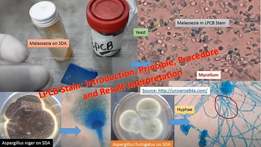 LPCB Stain: Introduction, Principle, Procedure, Result Interpretation