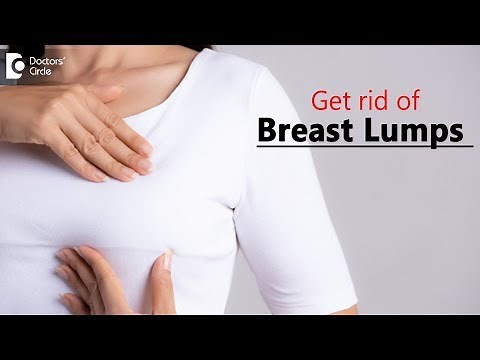 How do you get rid of breast lumps? - Dr. Nanda Rajaneesh
