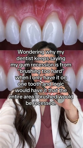Understanding Gum Recession Causes: Debunking Myths