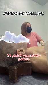 762K views · 3.5K reactions | aspiration of body fluids. | Umpukan cafe | Facebook