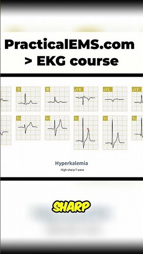 Hyperkalemia EKG Changes: Tall T Waves & Cardiac Arrest
