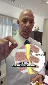 Here's What's Actually Happening When a Disc Herniates or Bulges