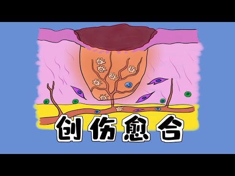 医学手绘|创伤愈合过程+肉芽组织 Medical hand-painted intensive lecture | wound healing process + granulation tissue