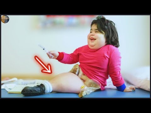 21 Most Unusual Babies Born With Features You’ve NEVER Seen Before! Part 2| Then and Now 2025