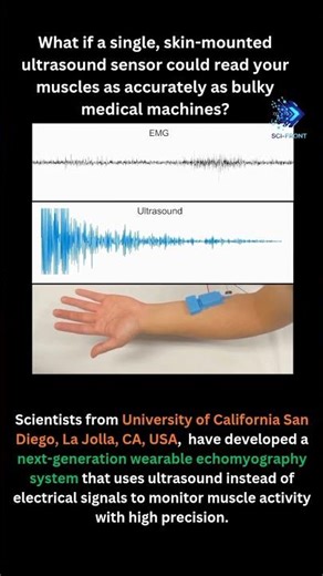 Wearable Echomyography: Ultrasound-Based Muscle Tracking with a Single Sensor