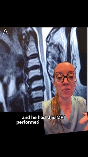 50K views · 2K reactions | Case study 101 - Progressive weakness...