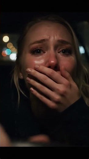 Unsuccessful lip augmentation procedure omg