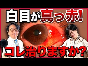 白目が真っ赤になる原因と対処法を眼科医が解説！
