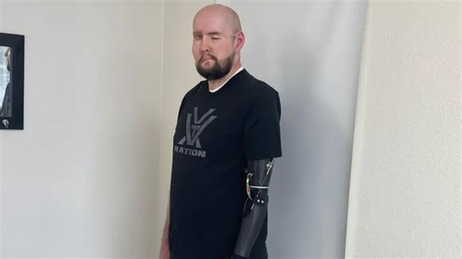 Man has world's first eye transplant and everyone is asking the same thing