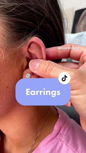 Bring on the BLING! Did you know our prostheses can support earrings?! #anaplastology #mosaicprosthetics #ear