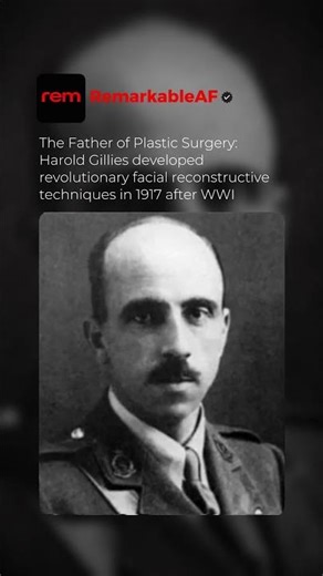 He Pioneered Plastic Surgery to Save Soldiers' Lives! #ww1 #plasticsurgery #usa #shorts