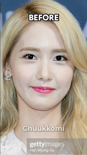 Kpop idols that had acne: before vs after Part 1#kpop