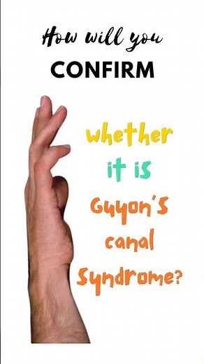 Confirmatory test for Guyon’s canal syndrome. Froment’s test. Ulnar tunnel syndrome #shorts