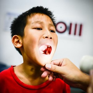 Does my child have strep infection? | theAsianparent Singapore