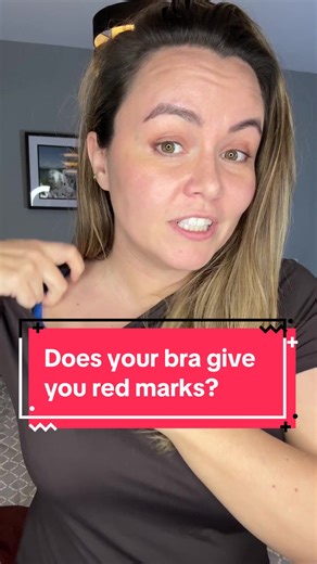 Understanding Bra Fit: Why Do We Get Red Marks?