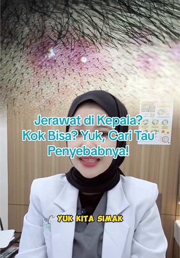 Jerawat di Kepala? Kok Bisa? Yuk, Cari Tau Penyebabnya!