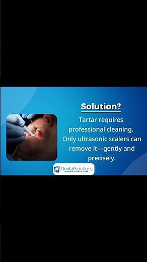 What Is Tartar and How Does It Form?