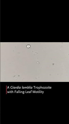 Falling-Leaf Motility of Giardia lamblia | NEJM