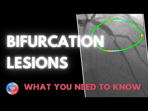Bifurcation Coronary Lesions