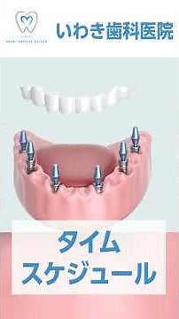 What is the timeline for All-on-4 treatment? How long does it last?