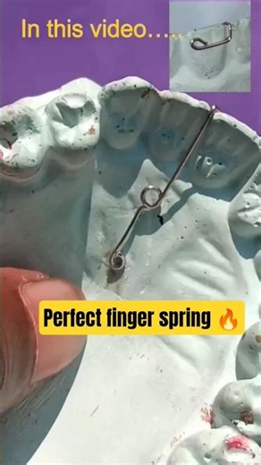 Perfect finger spring in 30 sec 🔥|Ortho practical Hack #youtubeshorts #shorts #educationalshorts