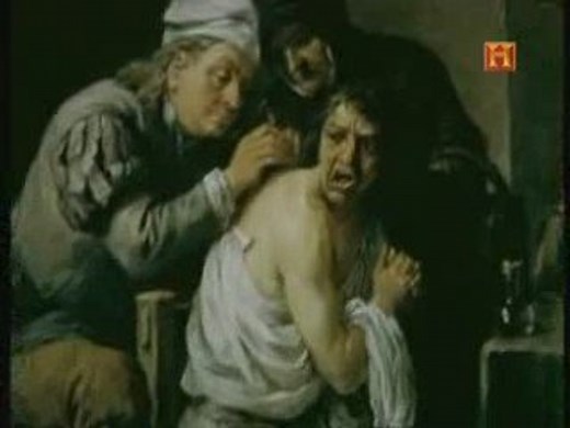 Historia de la anestesia