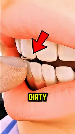Nail Biting Is More Dangerous Than You Think 😳