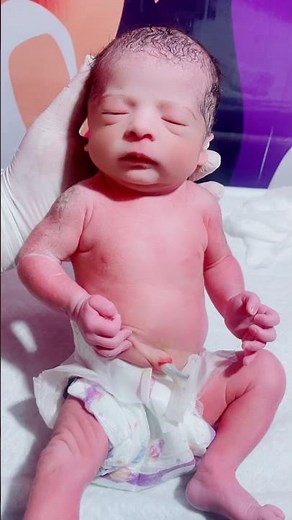 Cute Baby Girl Reflex Check | Newborn Examination 👶🩺 #newborncare #babygirl